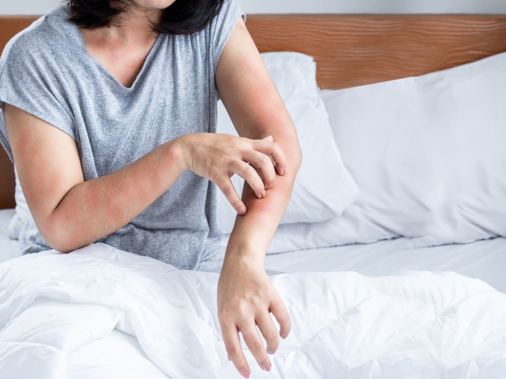 Ácaros en la cama: qué son, síntomas y cómo protegerte
